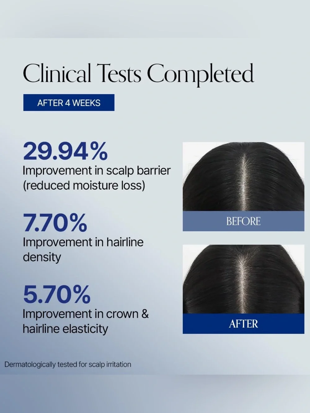 GrowUs Recover Therapy Hair Booster Serum EX- scalp care, thinning hair, upgrade